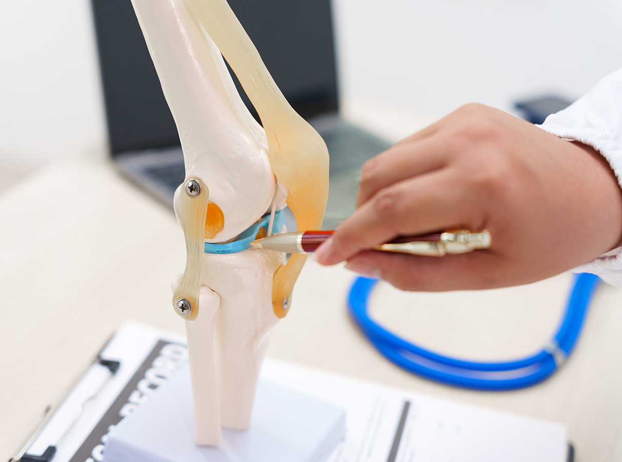 Prothèse de genou