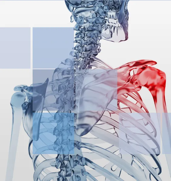 Chirurgie de la coiffe des rotateurs